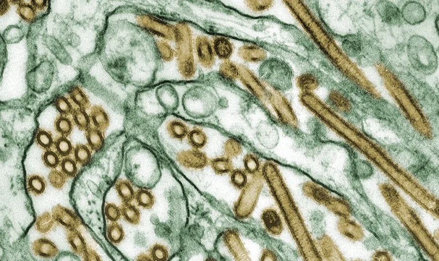 警报！CDC发现禽流感病毒变异，更容易传给人类！